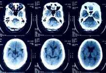 Why Uploading Medical Images to AI Chatbots is a Bad Idea news-20112024-003318